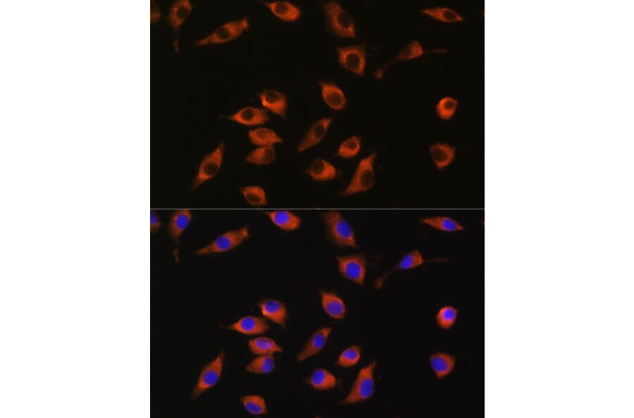 Immunofluorescence - Anti-SYT12 Antibody (A93332) - Antibodies.com