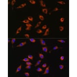 Immunofluorescence - Anti-SYT12 Antibody (A93332) - Antibodies.com