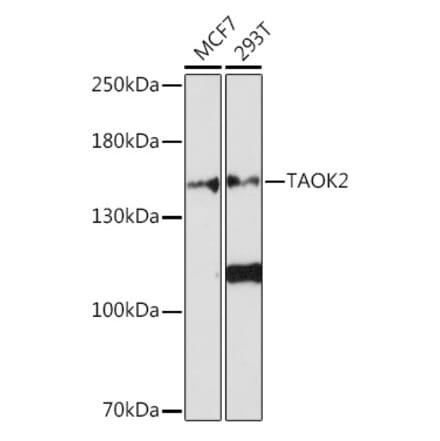 Western Blot - Anti-TAOK2 Antibody (A93335) - Antibodies.com