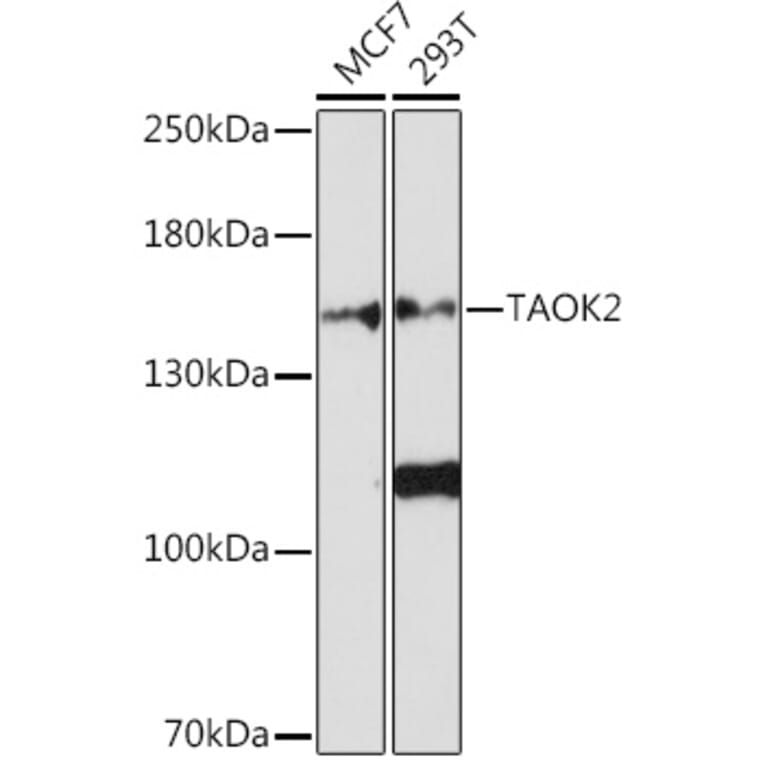 Western Blot - Anti-TAOK2 Antibody (A93335) - Antibodies.com