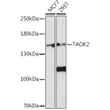Western Blot - Anti-TAOK2 Antibody (A93335) - Antibodies.com