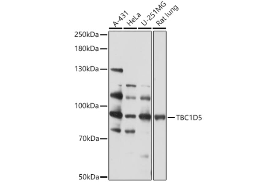 Western Blot - Anti-TBC1D5 Antibody (A93336) - Antibodies.com