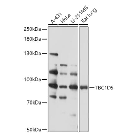 Western Blot - Anti-TBC1D5 Antibody (A93336) - Antibodies.com