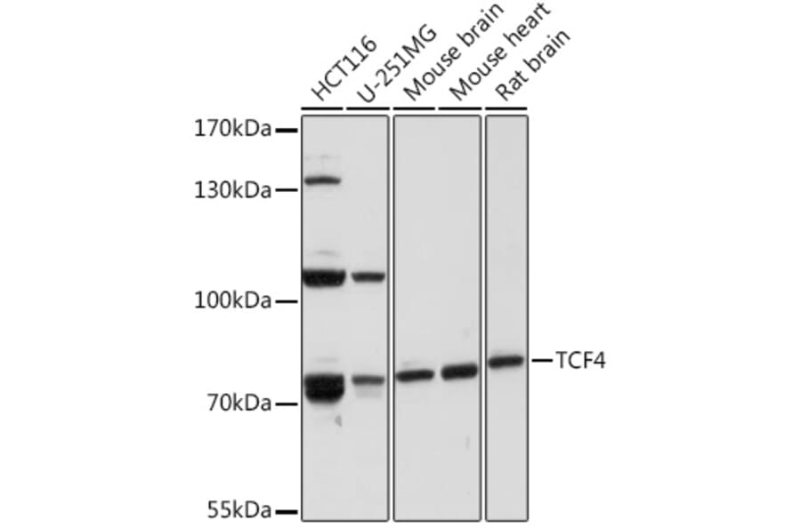 Western Blot - Anti-TCF-4 Antibody (A93338) - Antibodies.com