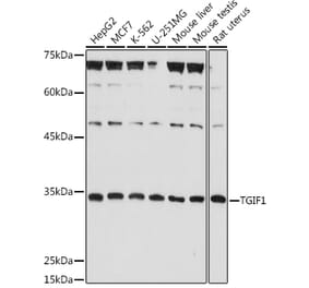 Western Blot - Anti-TGIF Antibody (A93339) - Antibodies.com