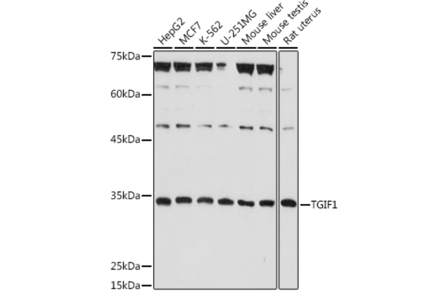 Western Blot - Anti-TGIF Antibody (A93339) - Antibodies.com