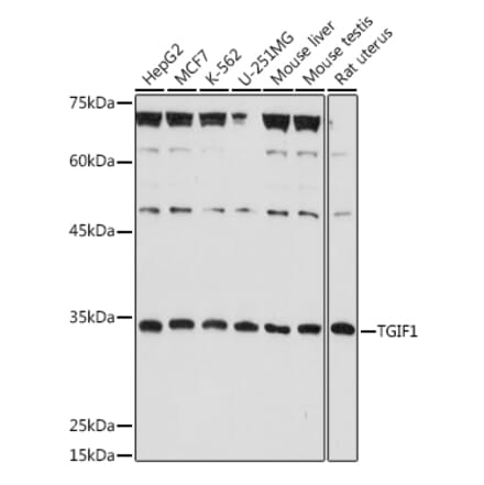 Western Blot - Anti-TGIF Antibody (A93339) - Antibodies.com