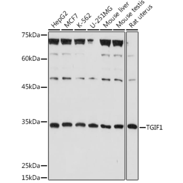 Western Blot - Anti-TGIF Antibody (A93339) - Antibodies.com