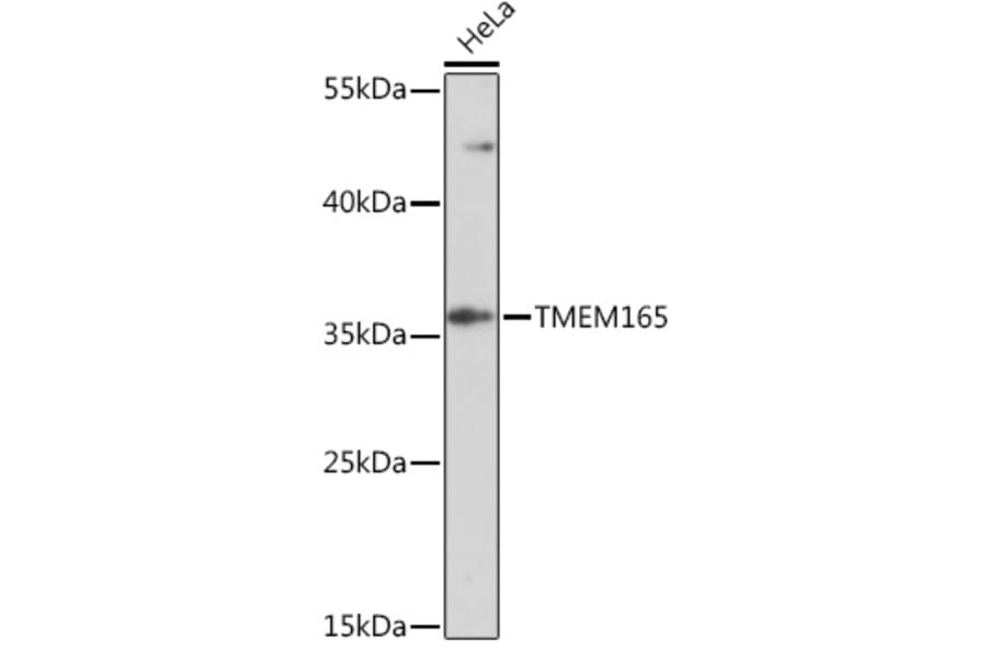Western Blot - Anti-TMEM165 Antibody (A93340) - Antibodies.com