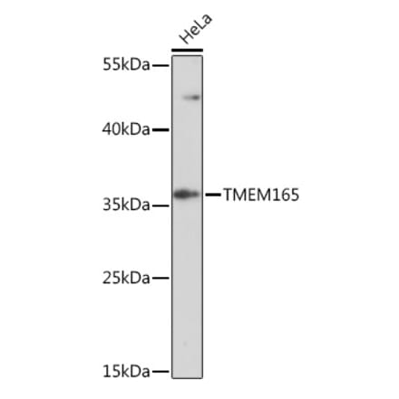 Western Blot - Anti-TMEM165 Antibody (A93340) - Antibodies.com
