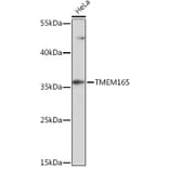 Western Blot - Anti-TMEM165 Antibody (A93340) - Antibodies.com