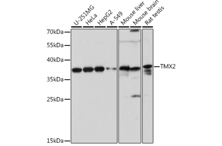 Western Blot - Anti-TMX2 Antibody (A93341) - Antibodies.com