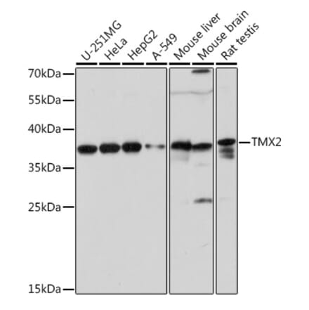 Western Blot - Anti-TMX2 Antibody (A93341) - Antibodies.com