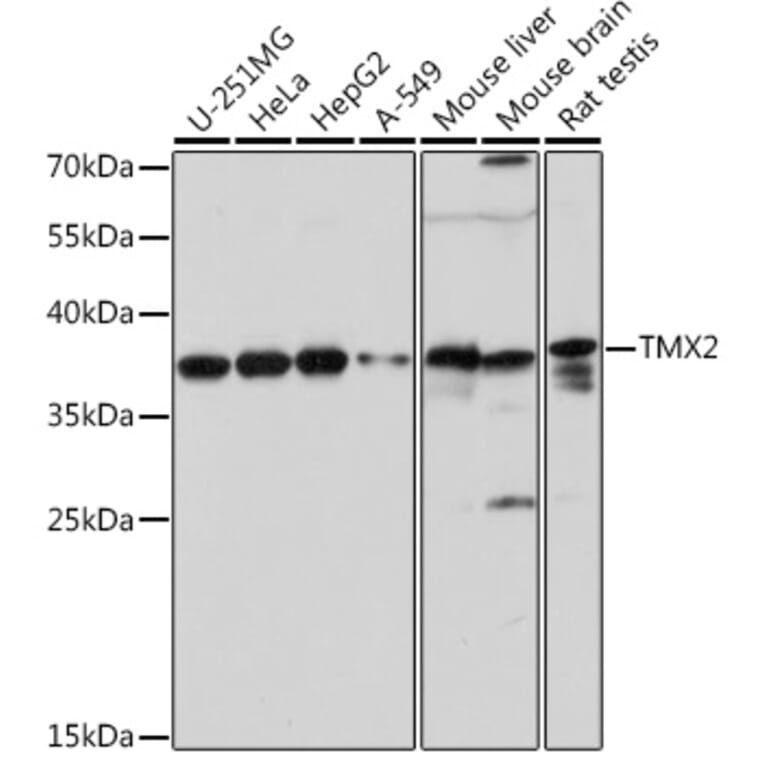 Western Blot - Anti-TMX2 Antibody (A93341) - Antibodies.com