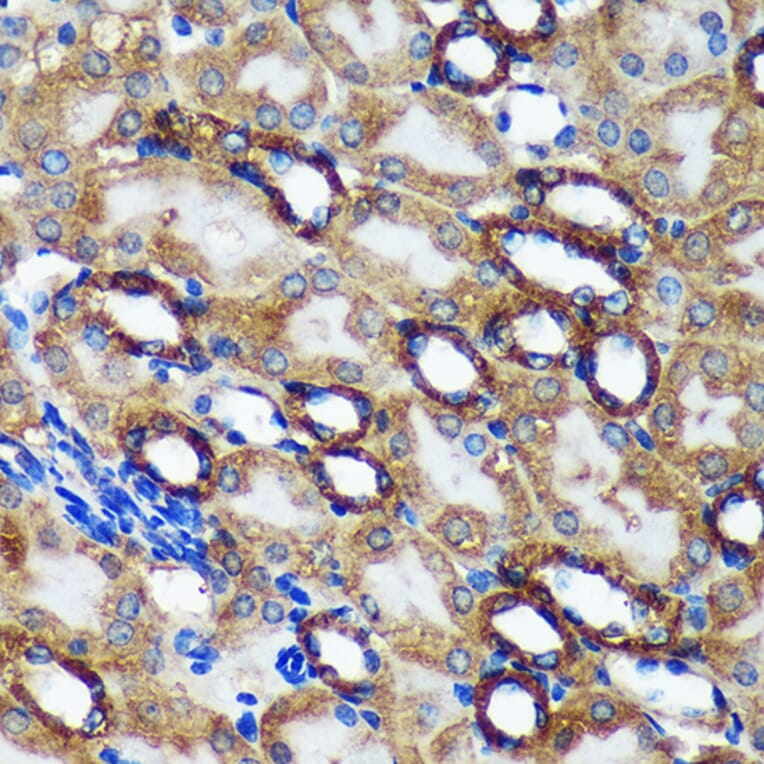 Immunohistochemistry - Anti-TMX2 Antibody (A93341) - Antibodies.com