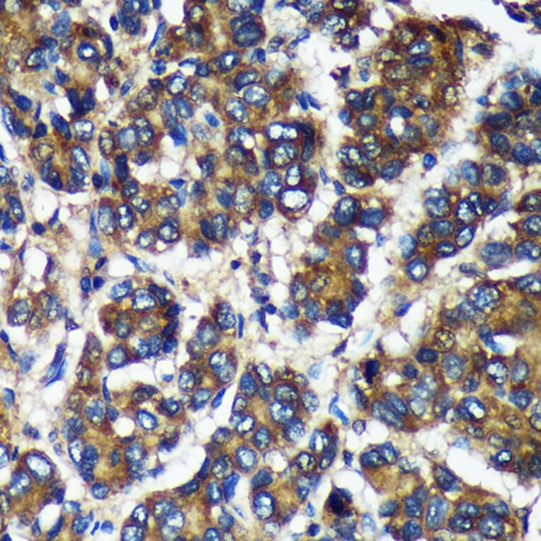 Immunohistochemistry - Anti-TMX2 Antibody (A93341) - Antibodies.com