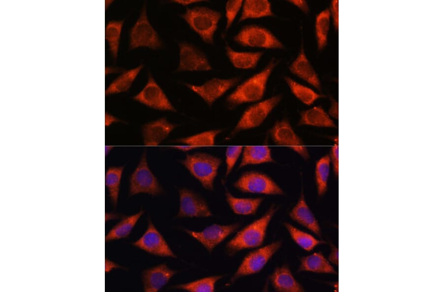 Immunofluorescence - Anti-TMX2 Antibody (A93341) - Antibodies.com