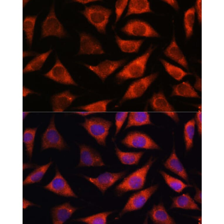 Immunofluorescence - Anti-TMX2 Antibody (A93341) - Antibodies.com