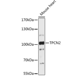 Western Blot - Anti-TPC2 Antibody (A93343) - Antibodies.com