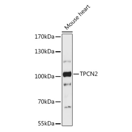 Western Blot - Anti-TPC2 Antibody (A93343) - Antibodies.com
