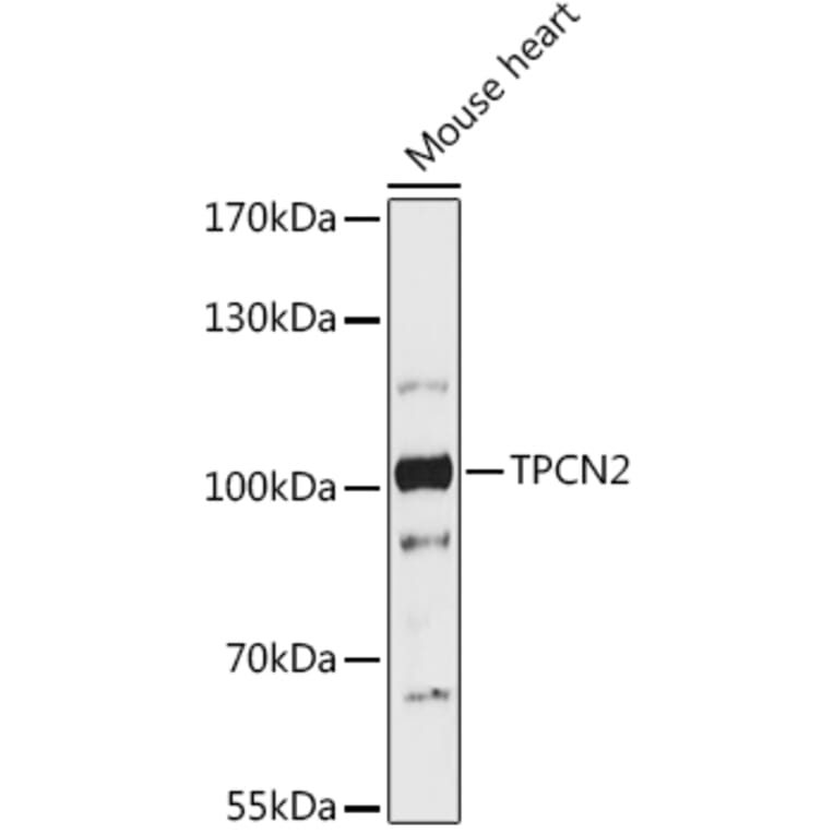 Western Blot - Anti-TPC2 Antibody (A93343) - Antibodies.com