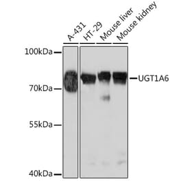 Western Blot - Anti-UGT1A6 Antibody (A93347) - Antibodies.com