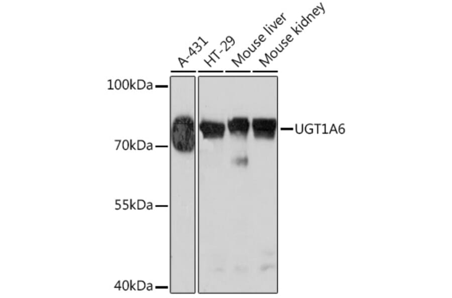 Western Blot - Anti-UGT1A6 Antibody (A93347) - Antibodies.com
