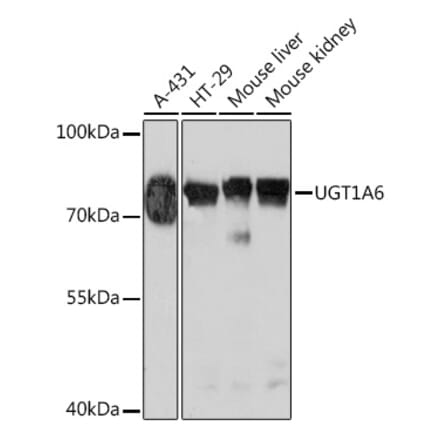 Western Blot - Anti-UGT1A6 Antibody (A93347) - Antibodies.com