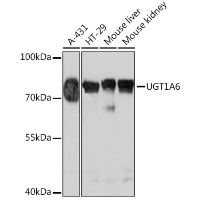 Western Blot - Anti-UGT1A6 Antibody (A93347) - Antibodies.com