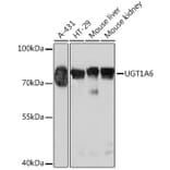 Western Blot - Anti-UGT1A6 Antibody (A93347) - Antibodies.com