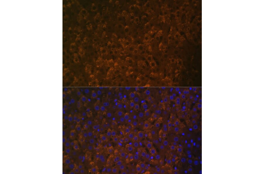 Immunofluorescence - Anti-UGT1A6 Antibody (A93347) - Antibodies.com