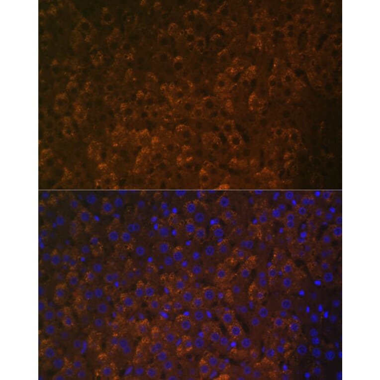 Immunofluorescence - Anti-UGT1A6 Antibody (A93347) - Antibodies.com
