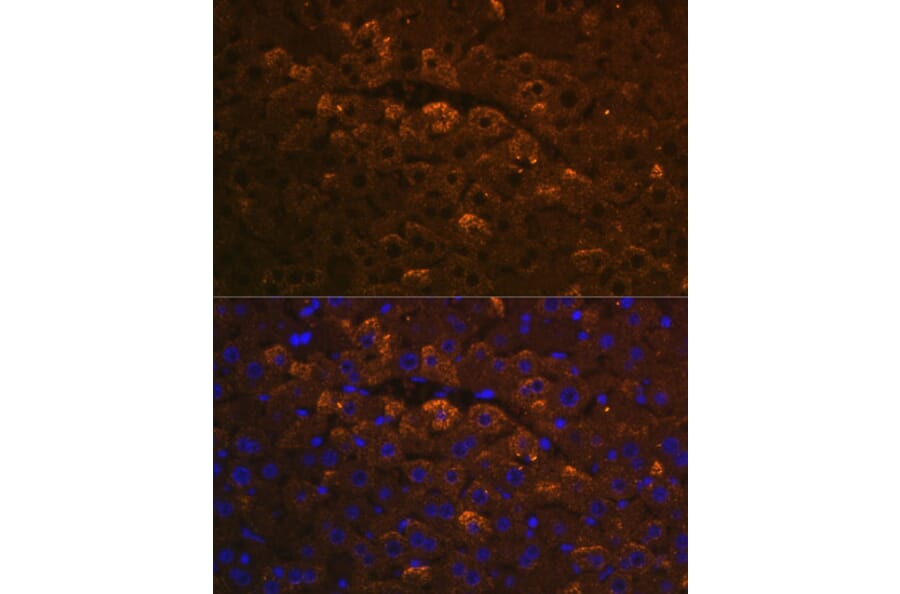 Immunofluorescence - Anti-UGT1A6 Antibody (A93347) - Antibodies.com