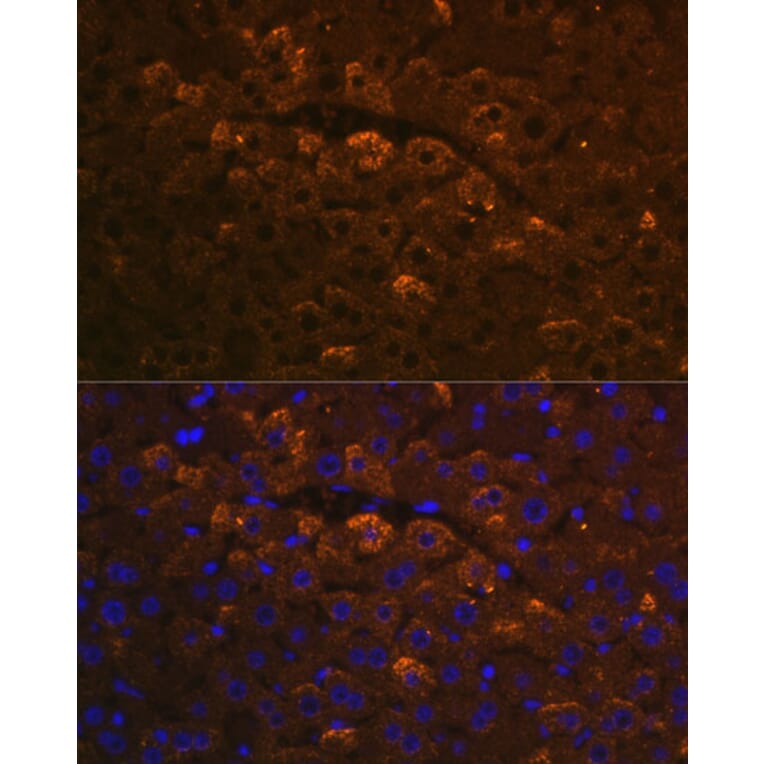 Immunofluorescence - Anti-UGT1A6 Antibody (A93347) - Antibodies.com