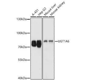 Western Blot - Anti-UGT1A6 Antibody (A93348) - Antibodies.com