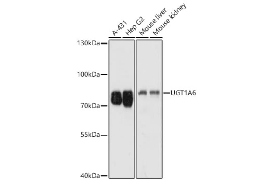 Western Blot - Anti-UGT1A6 Antibody (A93348) - Antibodies.com