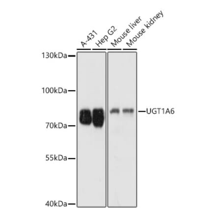 Western Blot - Anti-UGT1A6 Antibody (A93348) - Antibodies.com