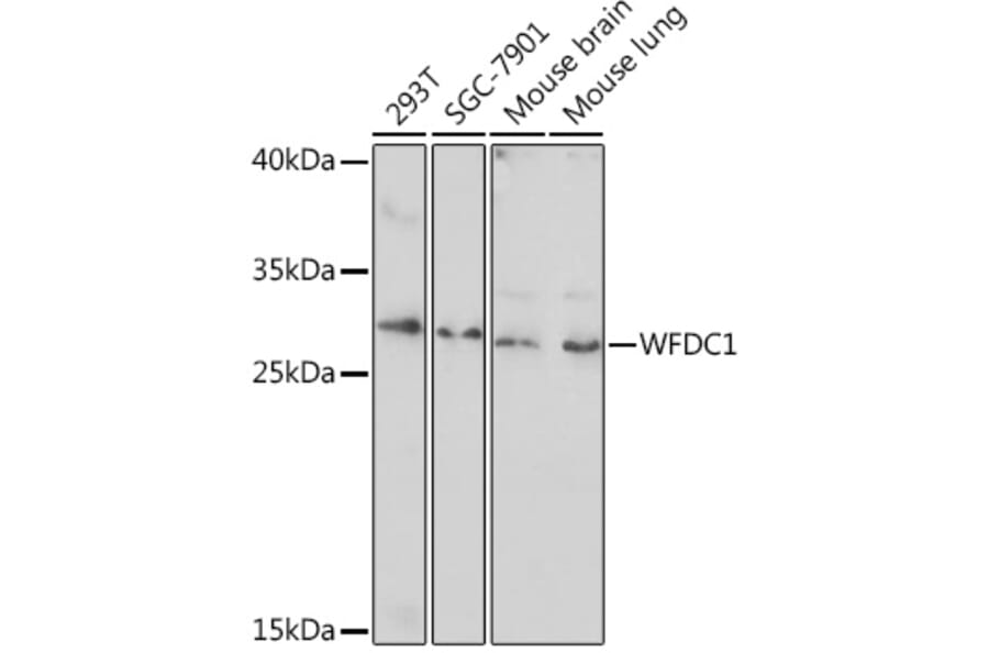 Western Blot - Anti-WFDC1/PS20 Antibody (A93353) - Antibodies.com