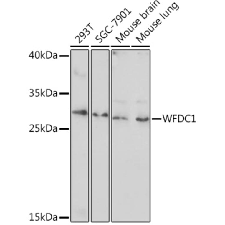 Western Blot - Anti-WFDC1/PS20 Antibody (A93353) - Antibodies.com