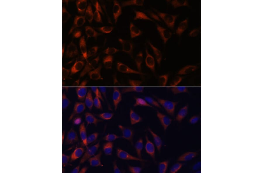 Immunofluorescence - Anti-WFDC1/PS20 Antibody (A93353) - Antibodies.com