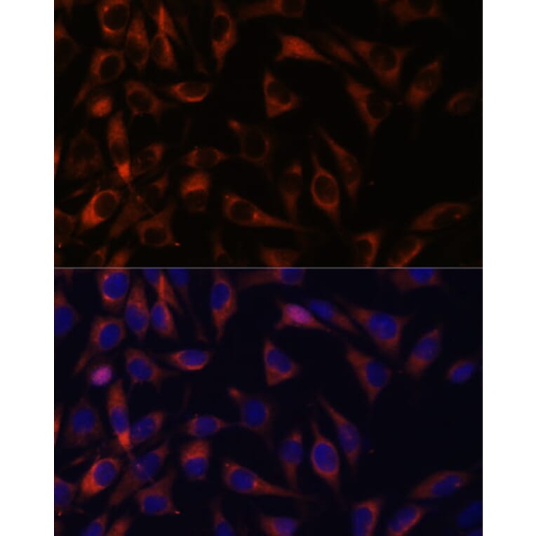 Immunofluorescence - Anti-WFDC1/PS20 Antibody (A93353) - Antibodies.com
