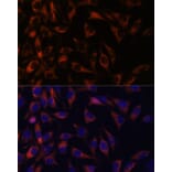 Immunofluorescence - Anti-WFDC1/PS20 Antibody (A93353) - Antibodies.com