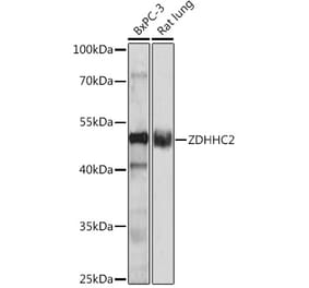 Western Blot - Anti-ZDHHC2 Antibody (A93355) - Antibodies.com