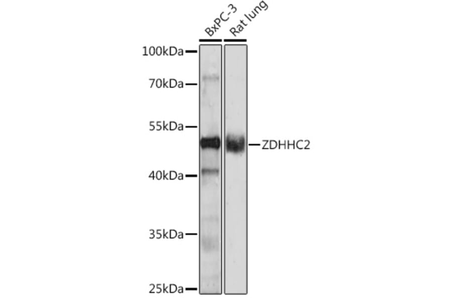 Western Blot - Anti-ZDHHC2 Antibody (A93355) - Antibodies.com