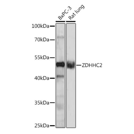 Western Blot - Anti-ZDHHC2 Antibody (A93355) - Antibodies.com