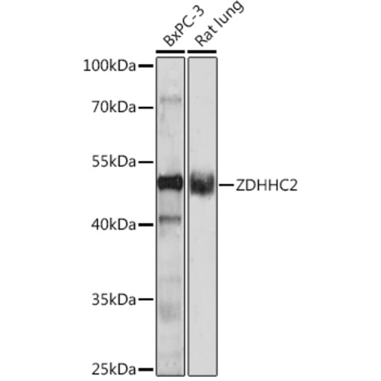 Western Blot - Anti-ZDHHC2 Antibody (A93355) - Antibodies.com