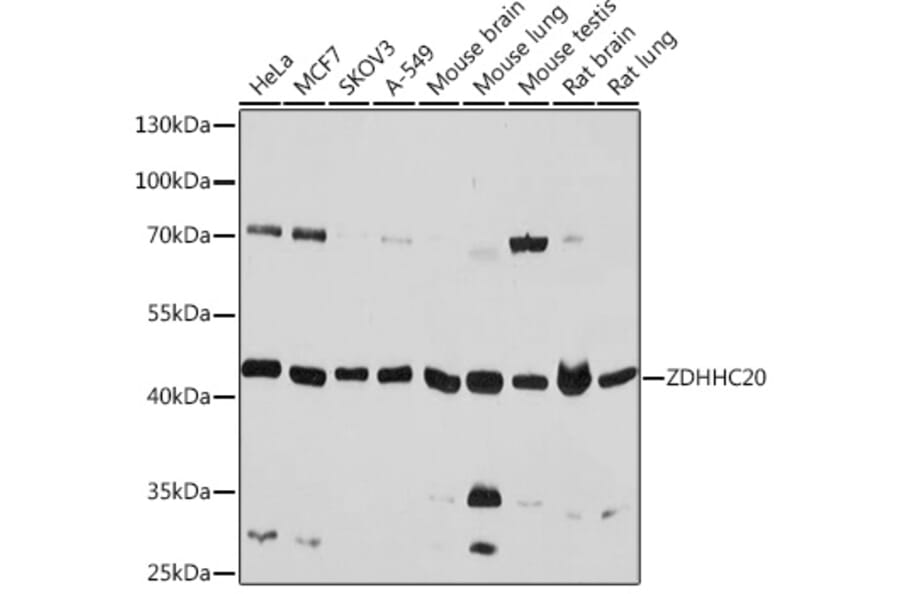 Western Blot - Anti-DHHC-20 Antibody (A93356) - Antibodies.com