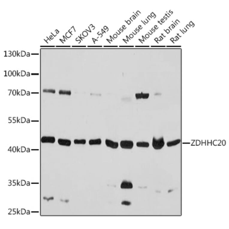 Western Blot - Anti-DHHC-20 Antibody (A93356) - Antibodies.com