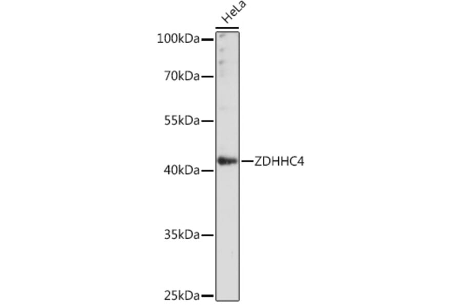 Western Blot - Anti-ZDHHC4/DC1 Antibody (A93357) - Antibodies.com