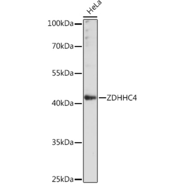 Western Blot - Anti-ZDHHC4/DC1 Antibody (A93357) - Antibodies.com